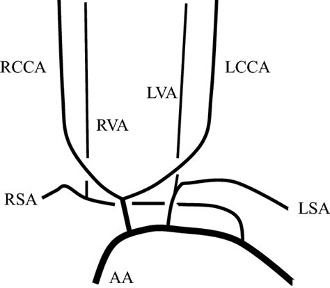 A Schematic Illustration Of Branching Variations Of This Patient In Ap Download Scientific