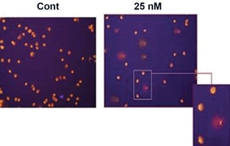 The Single Cell Gel Electrophoresis Comet Assay Of The Control And