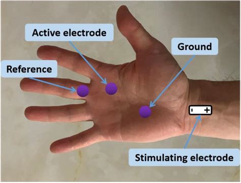 Hand Anatomy Lumbricals | Hot Sex Picture