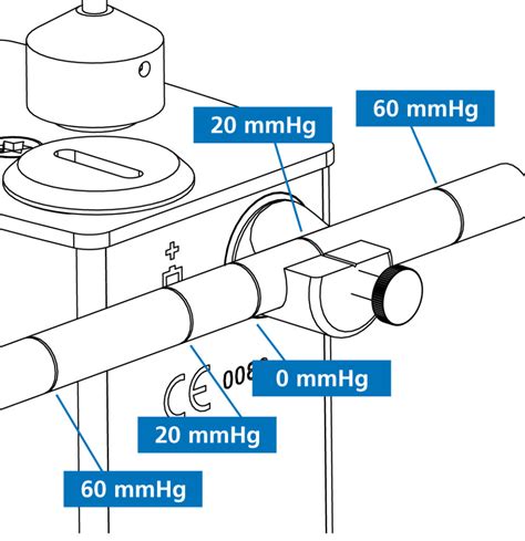 Goldmann tonometer calibration - Going for Goldmann