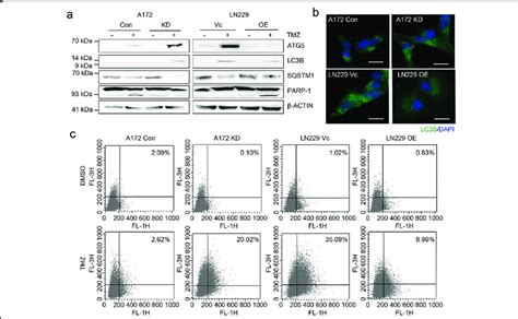 DAB2IP Inhibits TMZ Induced Autophagy A Representative Images Of