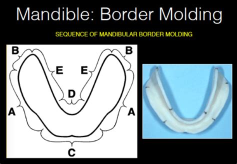 Cd4 Border Molding And Final Impression Flashcards Quizlet