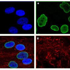 Immunofluorescence On Primary Dermal Fibroblasts From An Unaffected