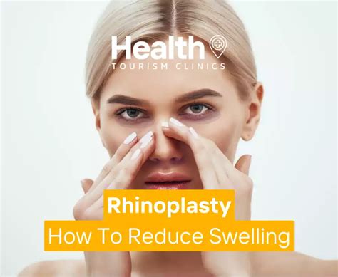 Rhinoplasty How To Reduce Swelling 2023 Health Tourism Clinics