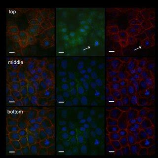 Representative Confocal Images Showing Cellular Localization Of