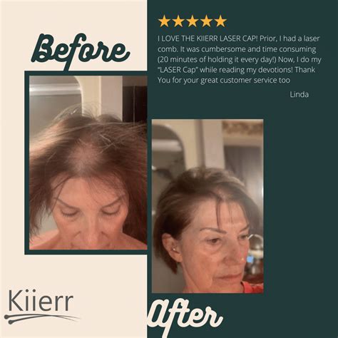 Kiierr Certified Refurbished 272Premier Laser Cap All Hair Growth