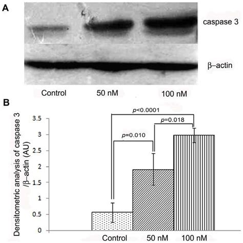 Immunoblot And Densitometric Analysis Of Caspase Representative