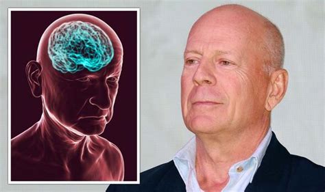 Bruce Willis health: Frontotemporal dementia symptoms may include ...