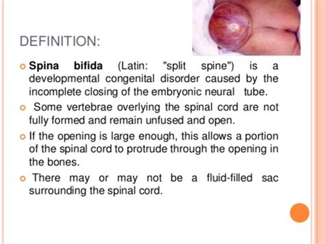 Spina Bifida Flashcards Quizlet