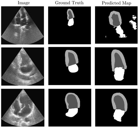 Vision Language Synthetic Data Enhances Echocardiography Downstream