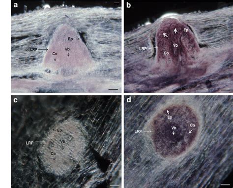 Localization Of Psapy1 Transcript In Lateral Root Primordia In