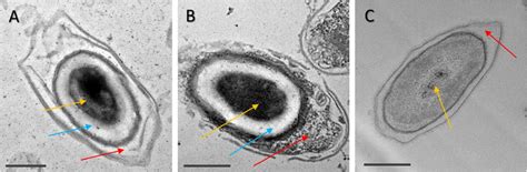 Representative TEM Micro Graphs Of C Difficile R20291 A And CD630