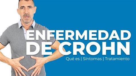 ENFERMEDAD DE CROHN Qué es Síntomas Tratamiento YouTube