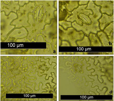 Anomocytic and diacytic stomatal type of Micromeria frivaldszkyana (a ...