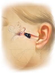 Invisible In The Canal Iic Hearing Aids Hearing Machine