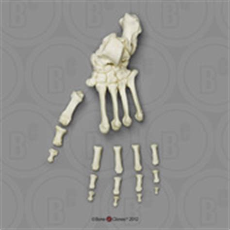 Meganthropus Skull - Bone Clones, Inc. - Osteological Reproductions