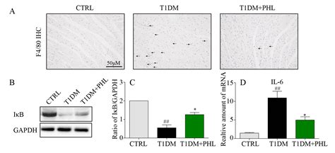 Phloretin Protects Against Cardiac Damage And Remodeling Via Restoring