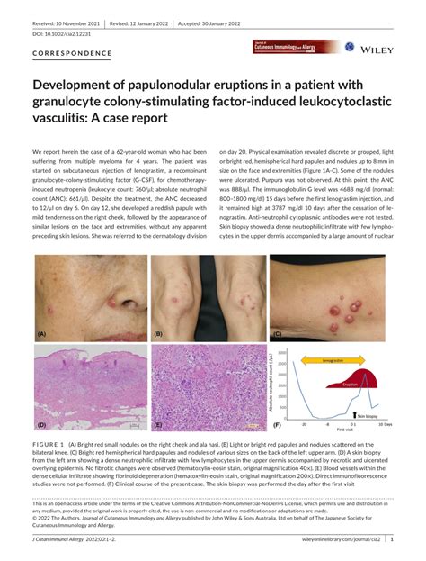 Pdf Development Of Papulonodular Eruptions In A Patient With