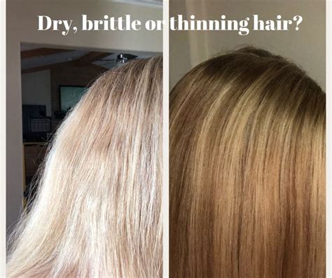 Secrets To Help Dry Brittle Or Thinning Hair Including Home Remedies For Hair Loss