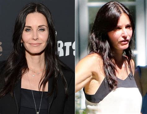 Courteney Cox before and after plastic surgery