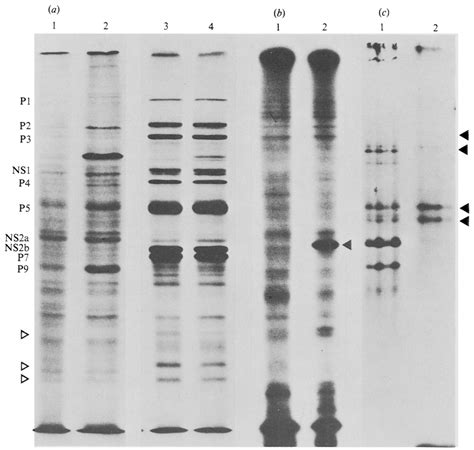 A Effect Of Tunicamycin On Abadina Virus Protein Synthesis Lane 1