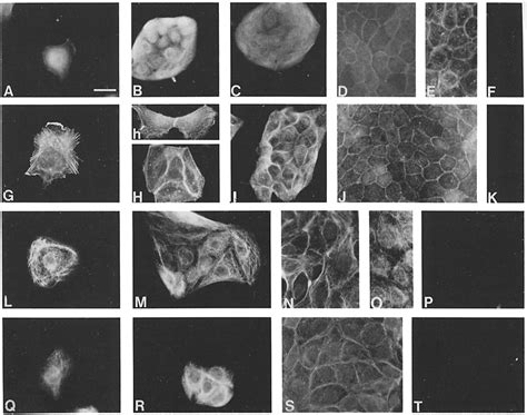 Indirect Immunofluorescence Of Cytoskeletal Proteins In Mdck Cells