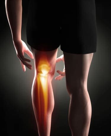 ACL Injury Prevention Program Strategies - Form & Function Physical Therapy