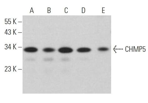 CHMP5抗体 D 11 SCBT Santa Cruz Biotechnology