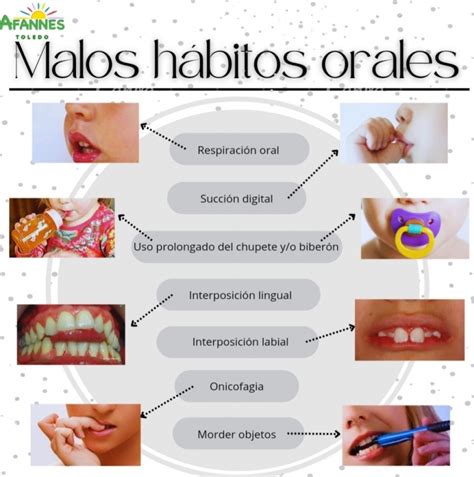 Malos hábitos orales AFANNES TOLEDO