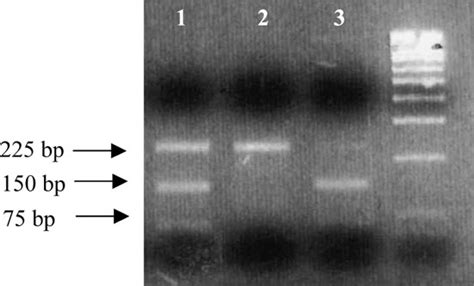 Pcr Rflp For Genotyping Of Snp 809 The Procedure Takes Advantage Of