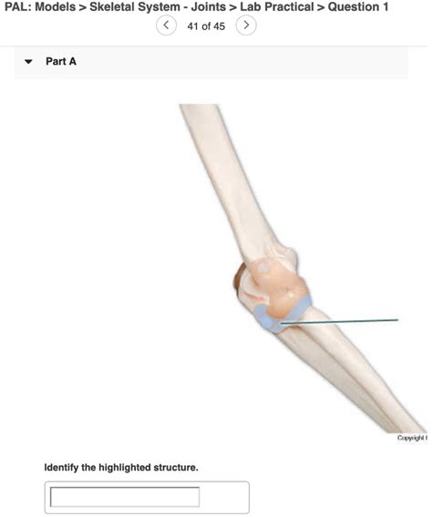 Solved PAL Cadaver Appendicular Skeleton Joints Lab Chegg