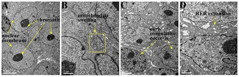 Picosecond Pulsed Electric Fields Induce Apoptosis In A Cervical Cancer