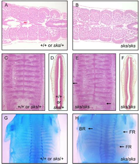 Multiple Skeletal Defects Of Sks Mutant Mice At Embryonic Stages A