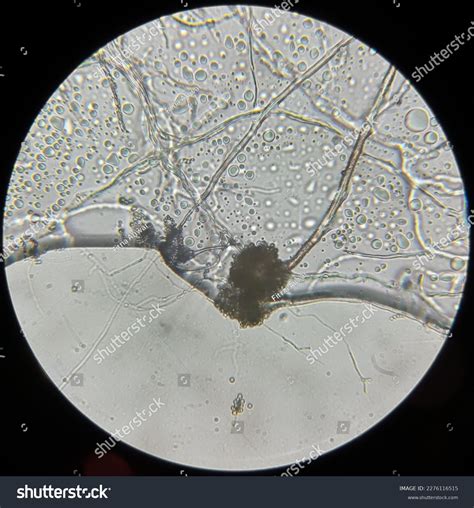 Aspergillus Niger Under Microscope 10x Subjective Stock Photo