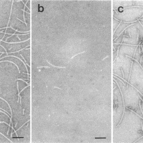 Electron Micrographs Of Negatively Stained Preparations Uranyl