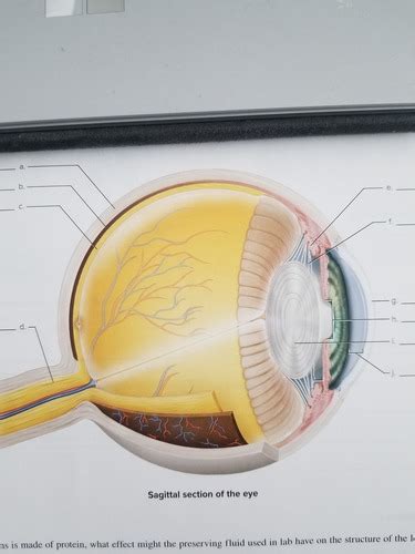 Ianatomy Of Eye And Ear Flashcards Quizlet