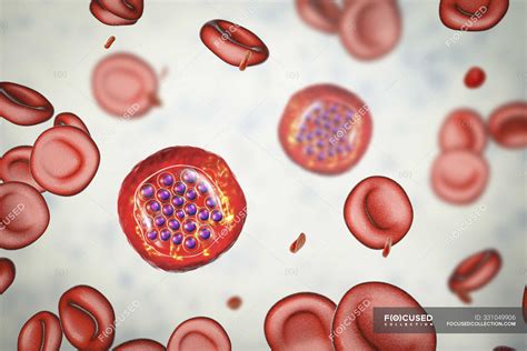 Protozoa plasmodium falciparum, Erreger der tropischen Malaria in roten ...