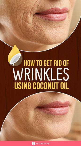 How To Get Rid Of Wrinkles Using Coconut Oil Artofit