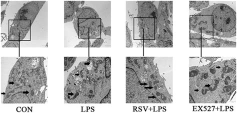 Full Article The Effects Of Sirt1foxo1 On Lps Induced Ins 1 Cells