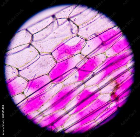 Plant Cell Under Microscope 400x