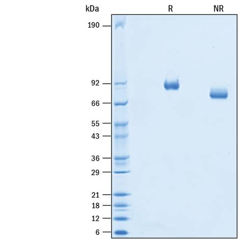 Recombinant Human Melanotransferrin Cd His Protein Cf Mt