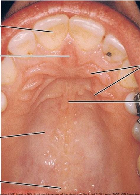 Inferior View Of Palate Landmarks Diagram Quizlet