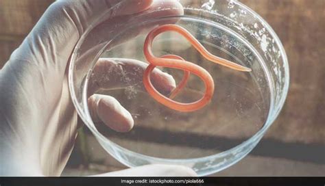 A Worm Removed From A Woman's Eye in Kerala