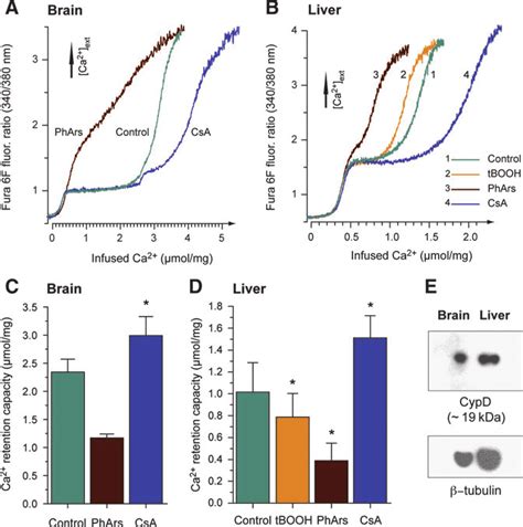 Modulation Of Calcium Retention Capacity In Human Brain And Liver