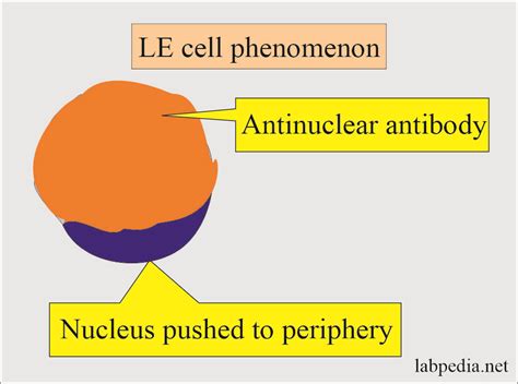 Antinuclear Factor Anf Antinuclear Antibody Ana And Its