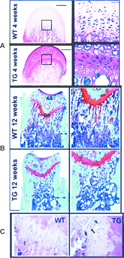 Mpaired Growth Plate Chondrocyte Proliferation And Maturation A