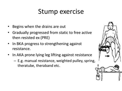 How I Do Below Knee Amputation