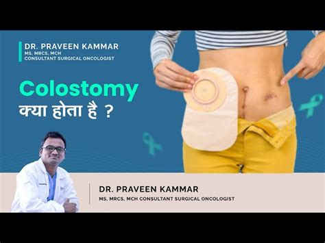 Colostomy A Surgical Procedure That Diverts Stool Dr Praveen Kammar