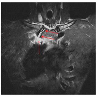 Computed Tomography CT Scan With Volume Rendering Technique VRT