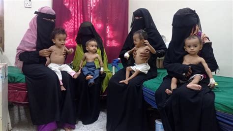 Children Starving in Yemen as Risk of War Continues